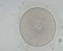 Stages of Oocyte Maturation
