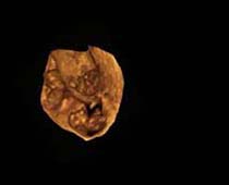 3D Ultrasound of Triplets 2