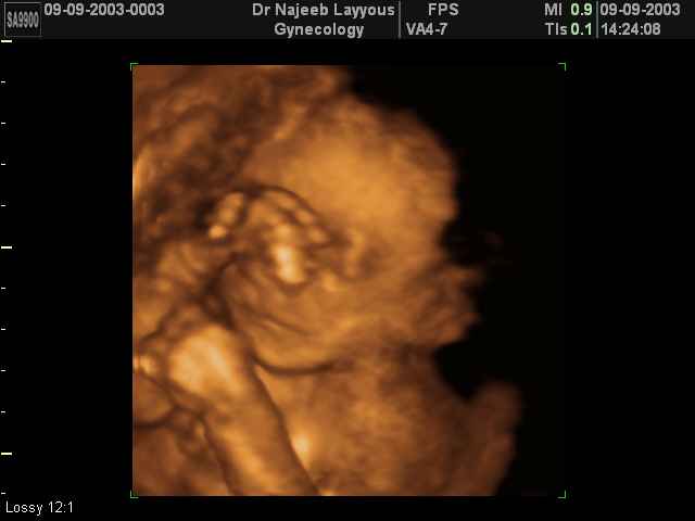 Rubbing eye,just woke up